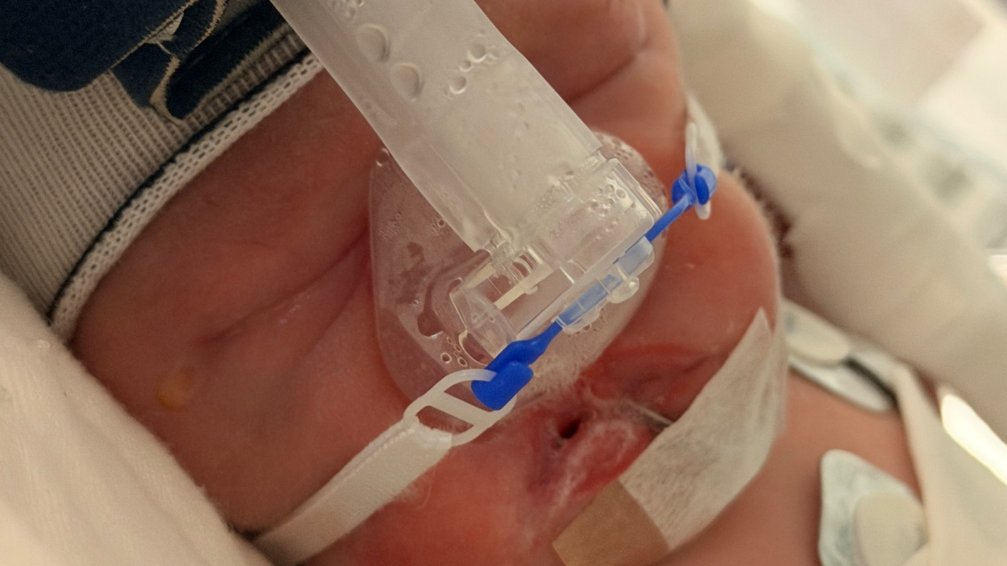 Nicu hotel stay and food