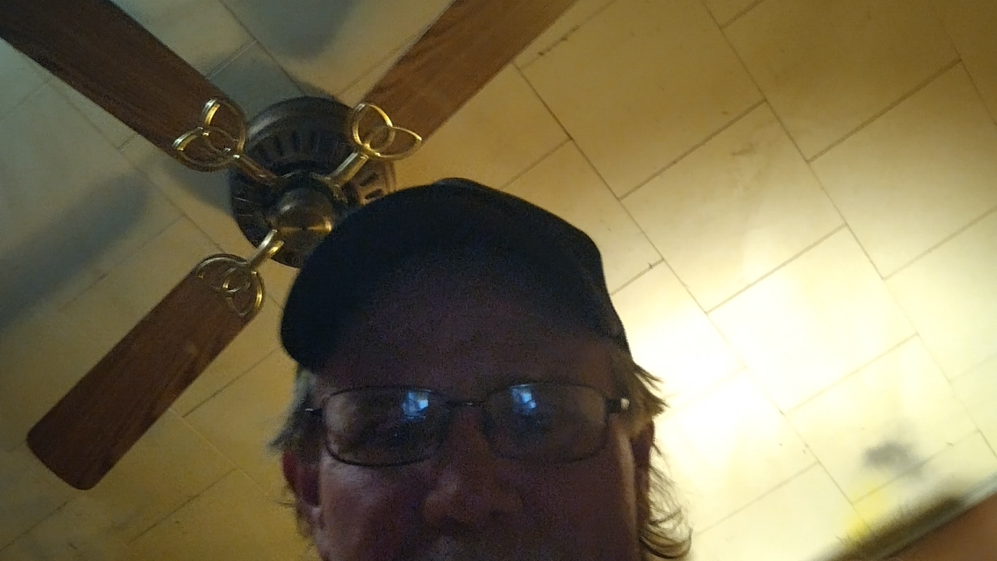 Surgery center fee for cataract surgery