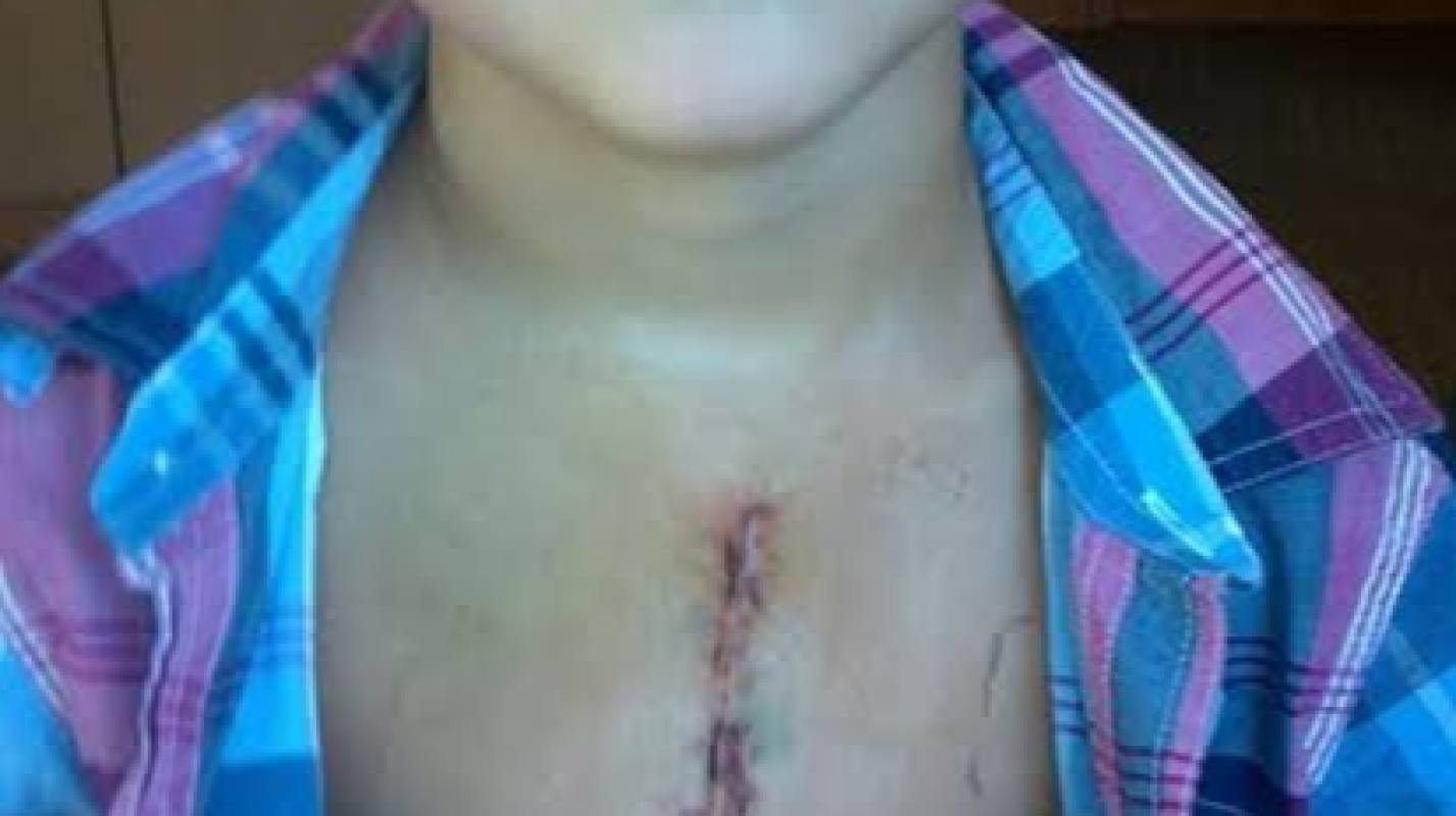 for surgery my son