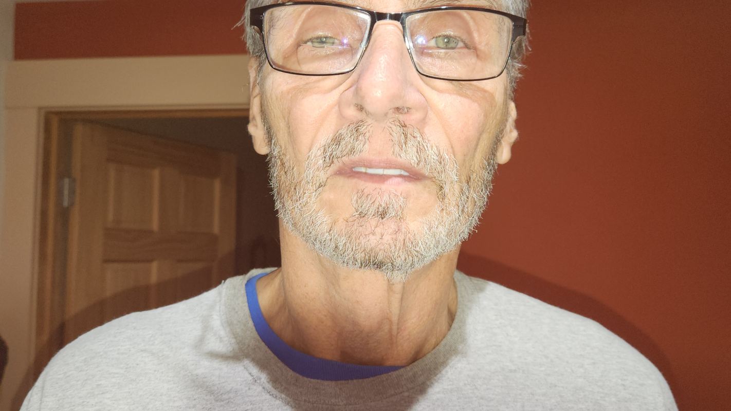 Beat Frank Hoys cancer with Envita