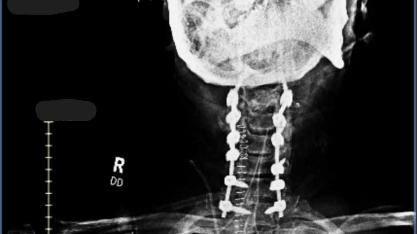 Help Shane Rebuild After a Life-Changing Injury