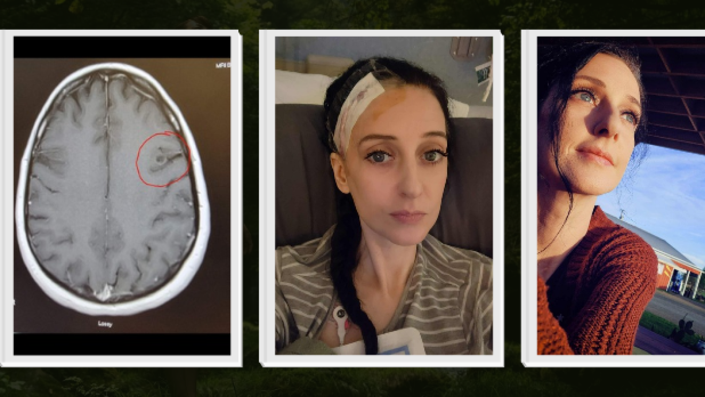 Amber (AJ) Hawkison's Brain Surgery Fund