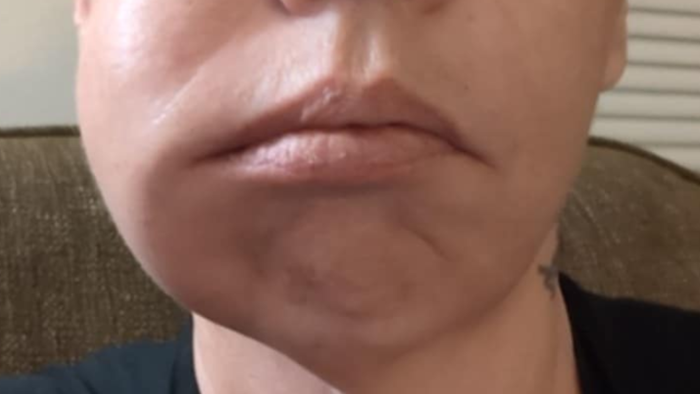 Need dental work bad!!!