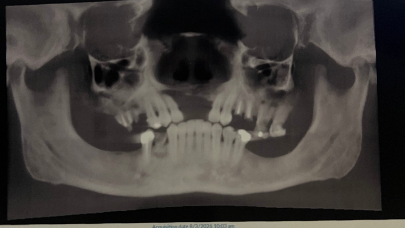 My dental Health