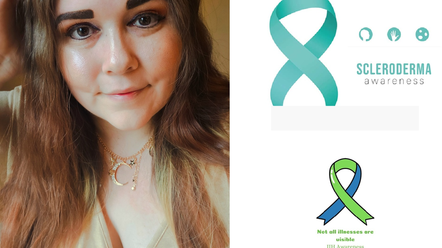 Medical Costs for Treating IIH and Scleroderma