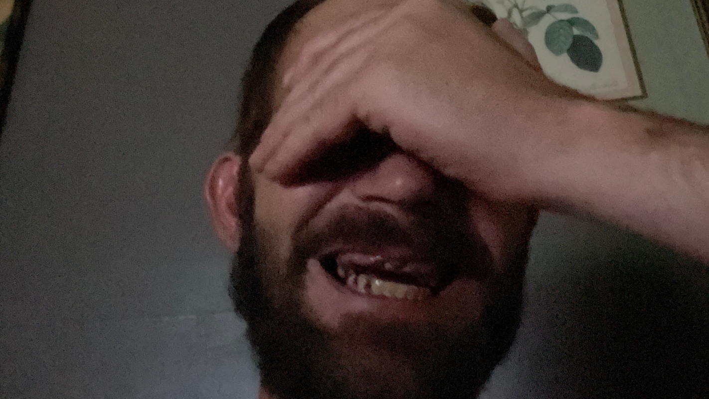 Scared of the dentist need put to sleep