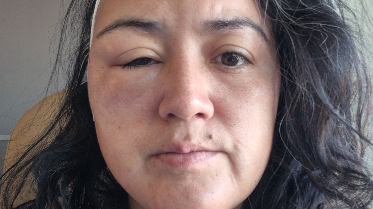 Disabled Navy Veteran • Medical Hardship