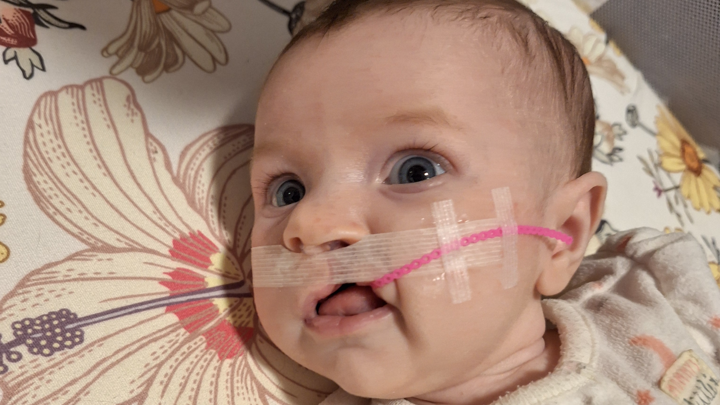 Cleft Care Journey for Ruth-Irene