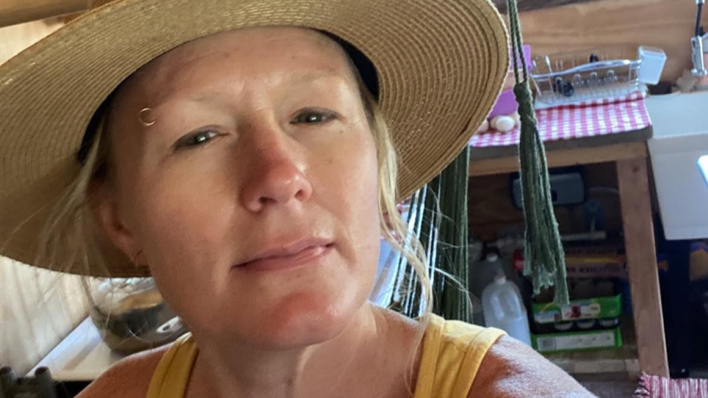 Healing for Mandy Burke: Together Against Melanoma