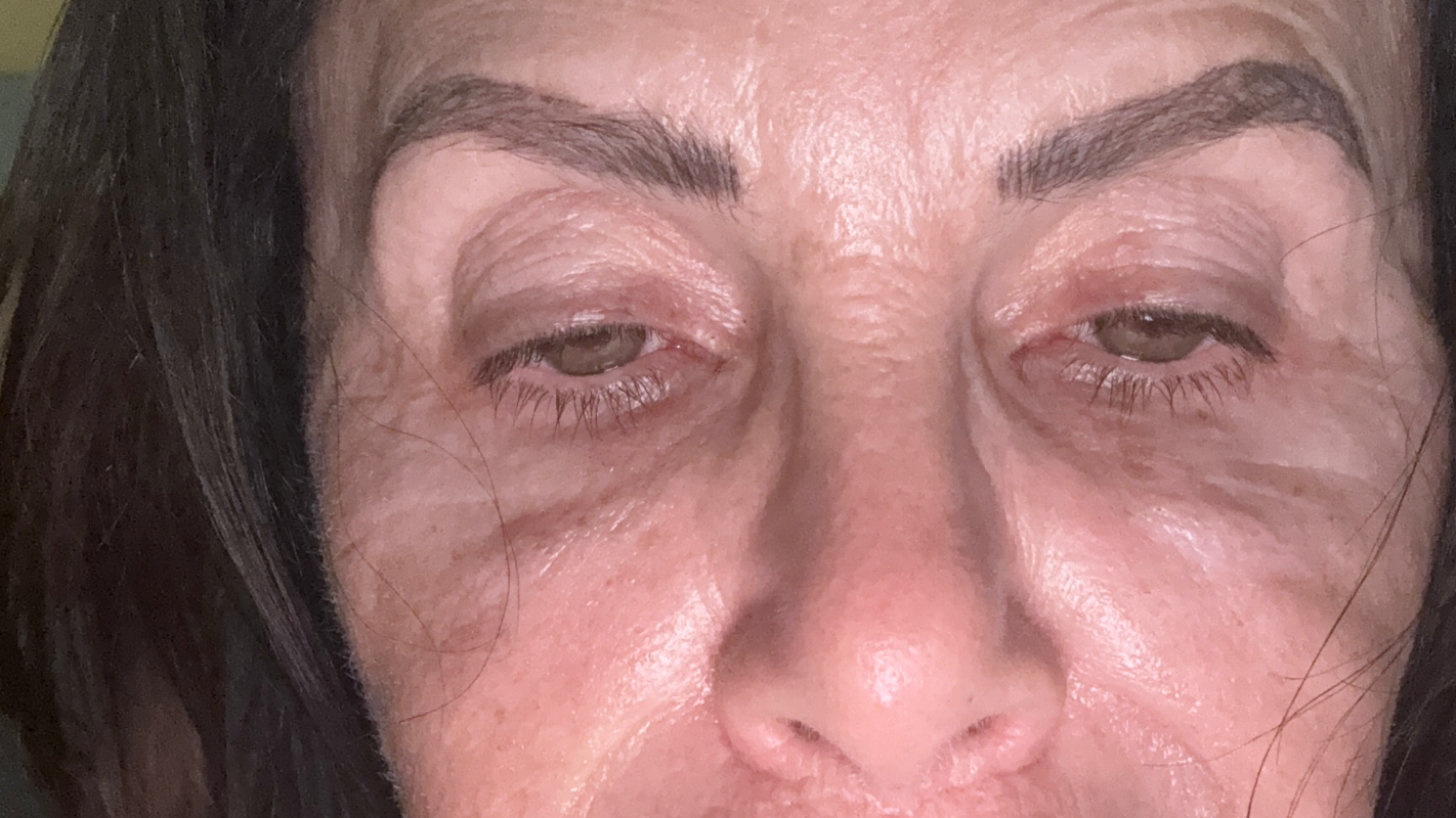 Help a person in Ukraine to do surgery