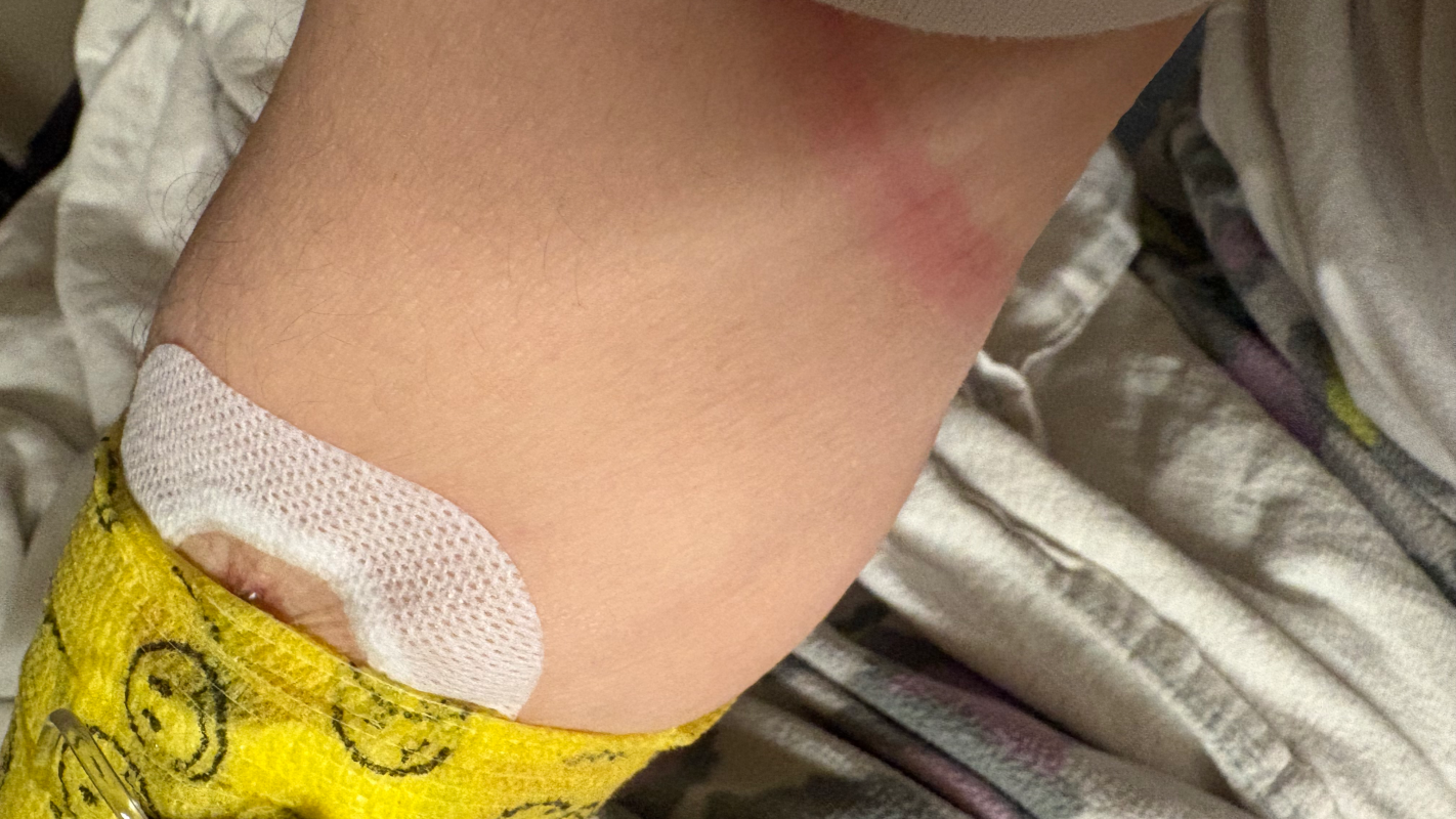 Medical and recovery