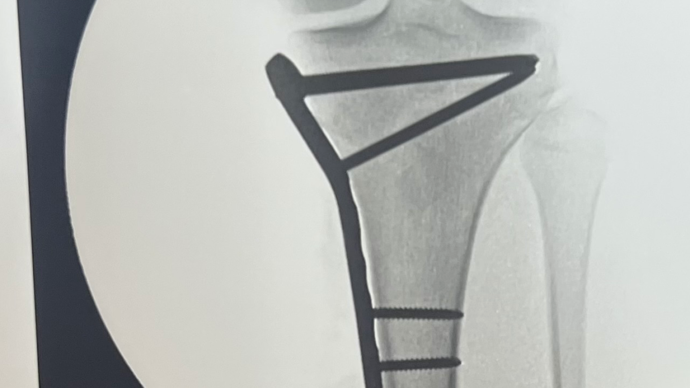 Brileigh’s medical bills