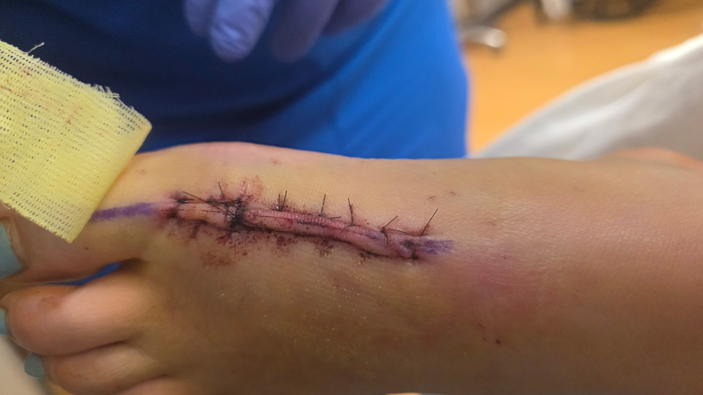 Lending an extra foot?