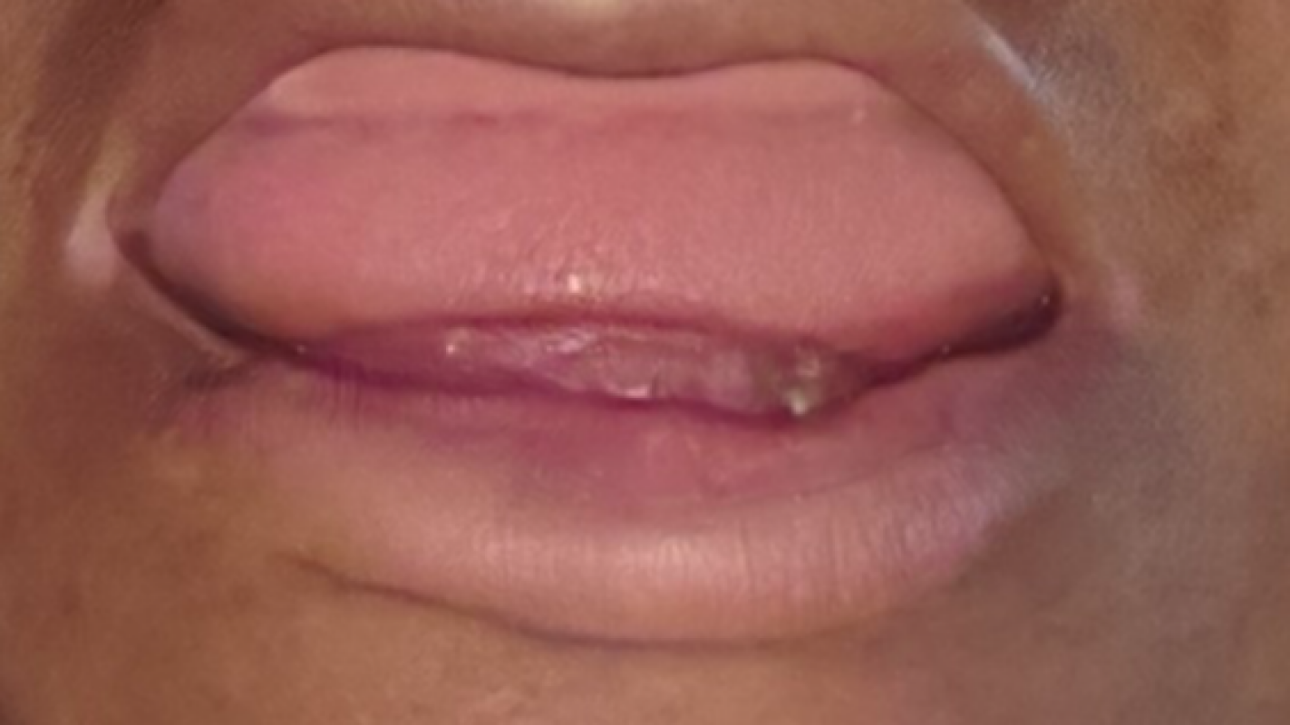 Help get my smile back.