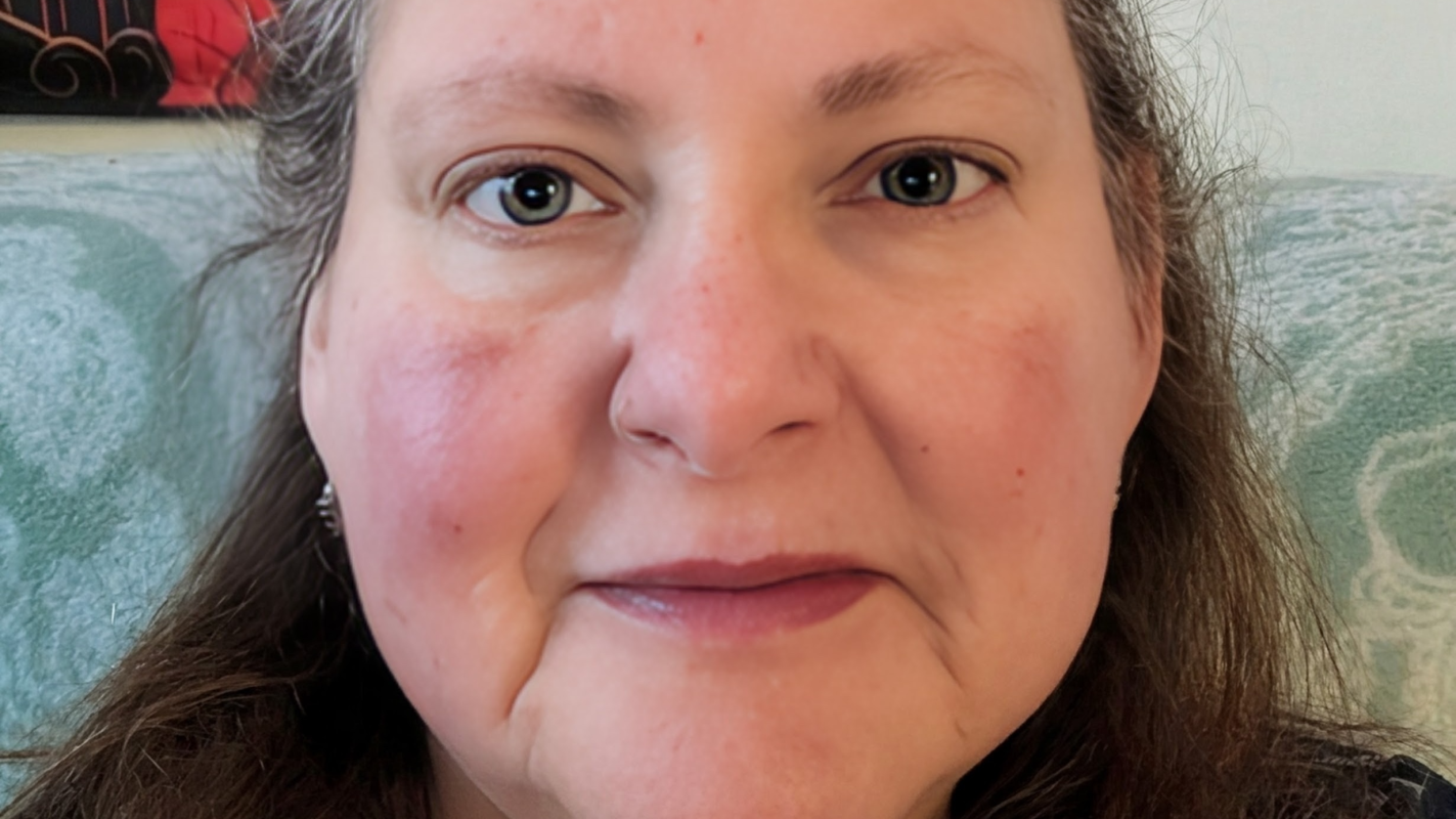 Please help me to smile confidently.