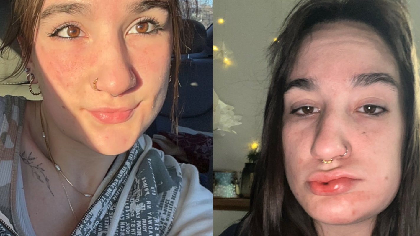 Laura’s Emergency Care