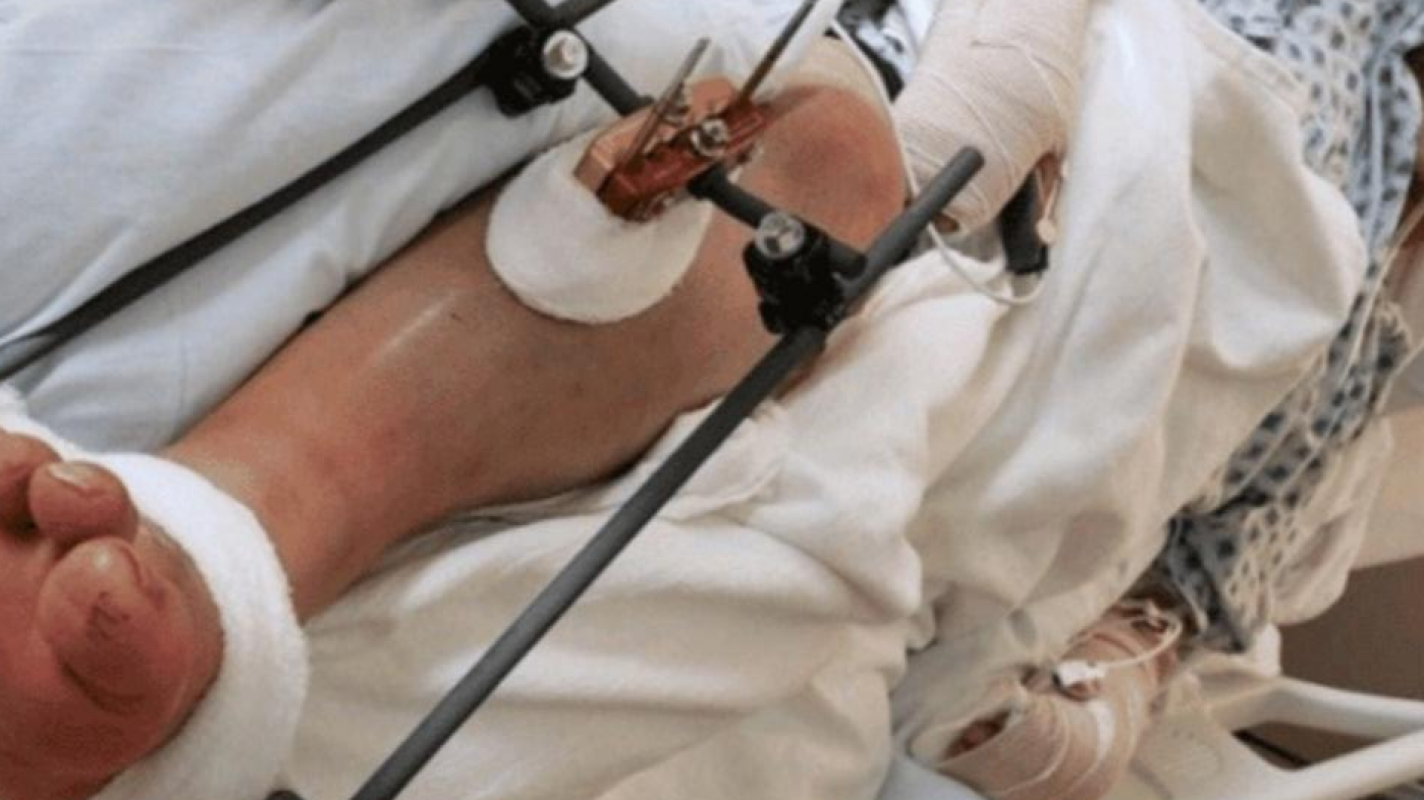 Urgent Surgery Needed After Tragic Accident