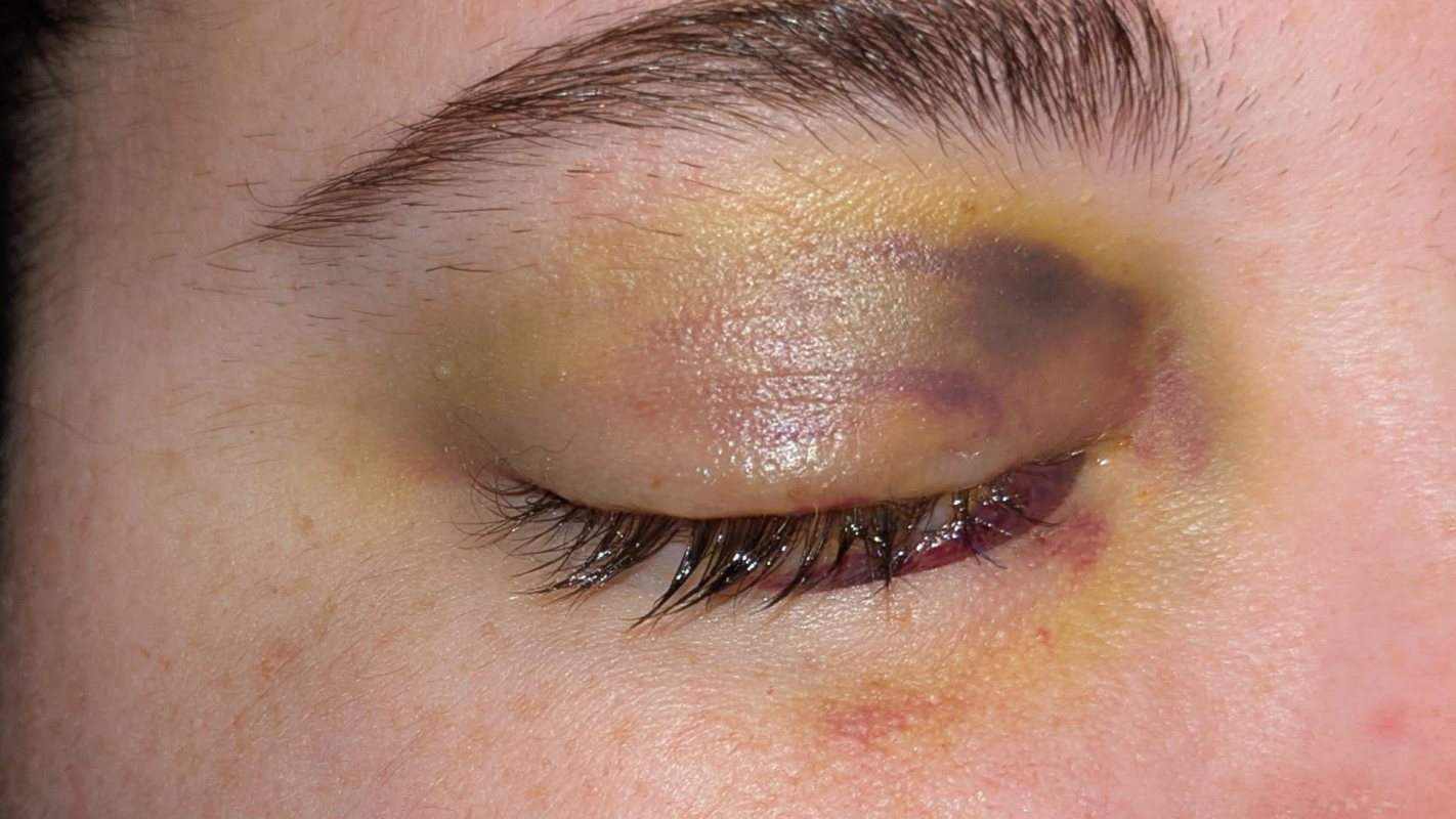 Amanda’s Medical Expenses