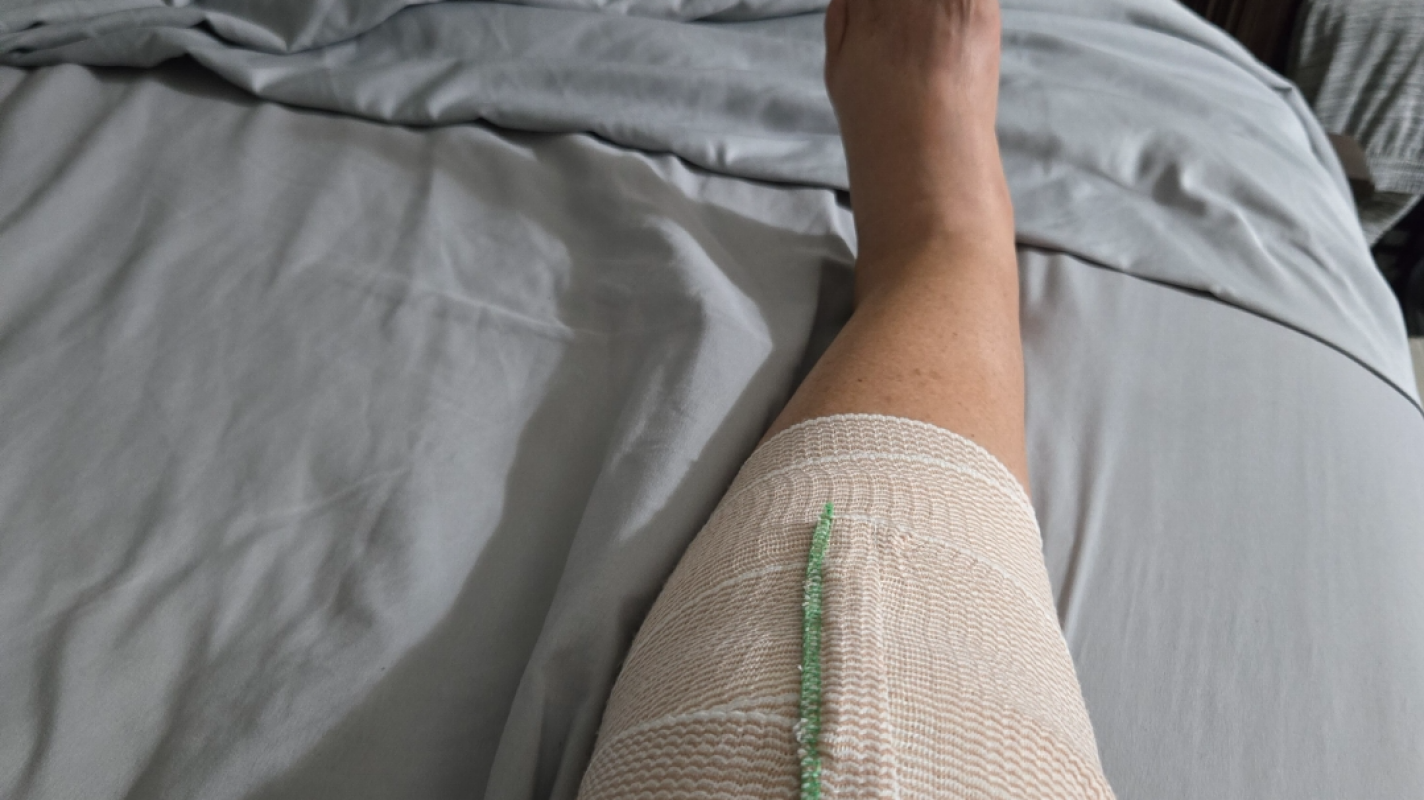 Knee surgery