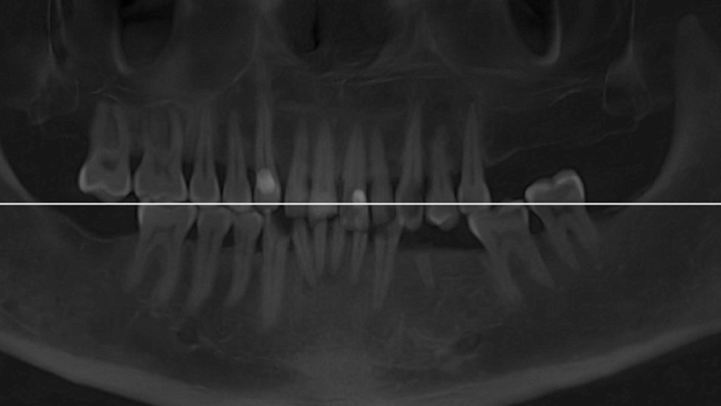 Help father/husband regain his smile and confidence