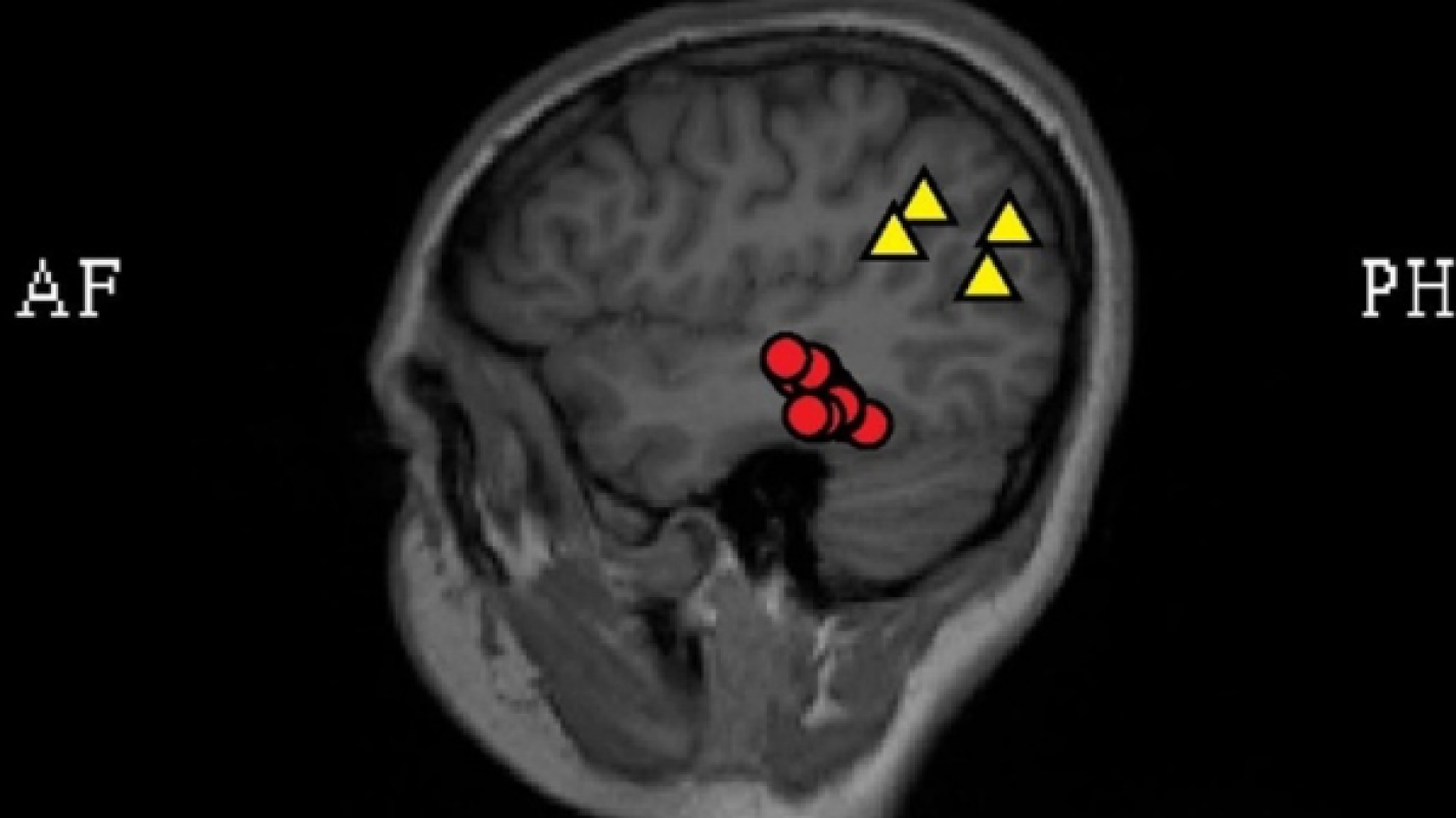 Brain surgery test