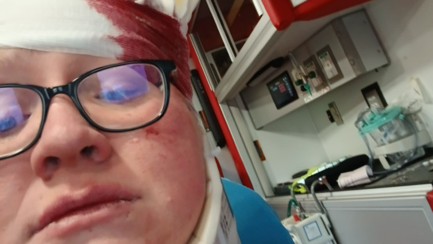 Help after Traumatic Head Injury