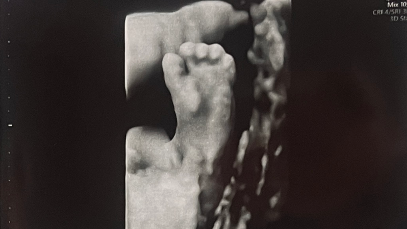 Grace and Miguel’s secret fundraiser