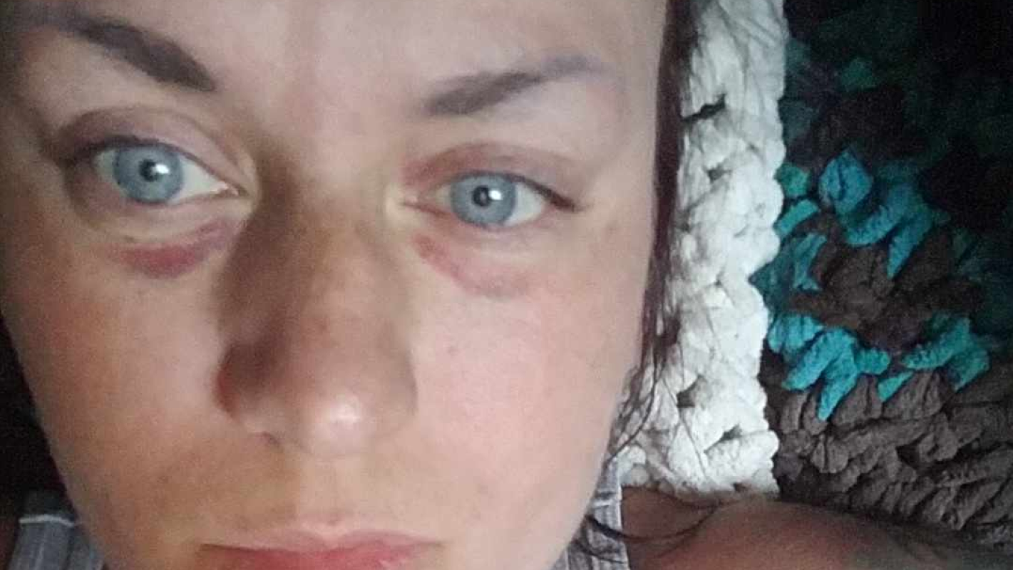 i was assaulted while working