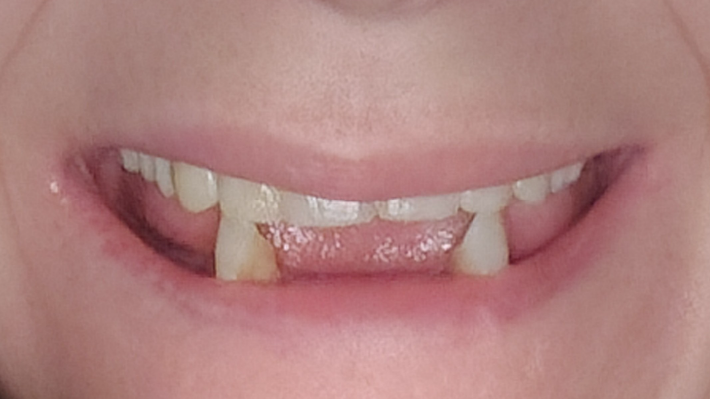 Finish my dental work.