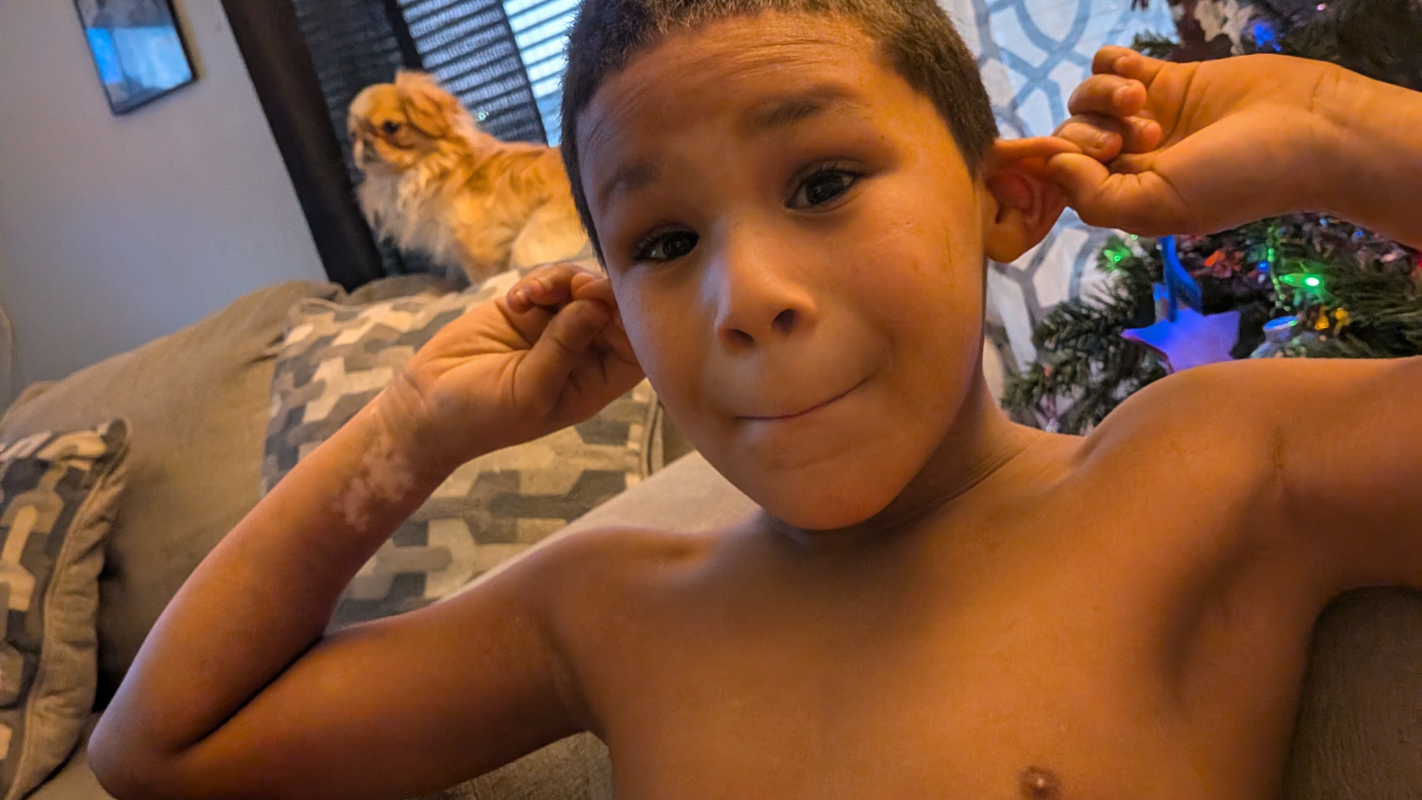 Medicine for my Sonshine