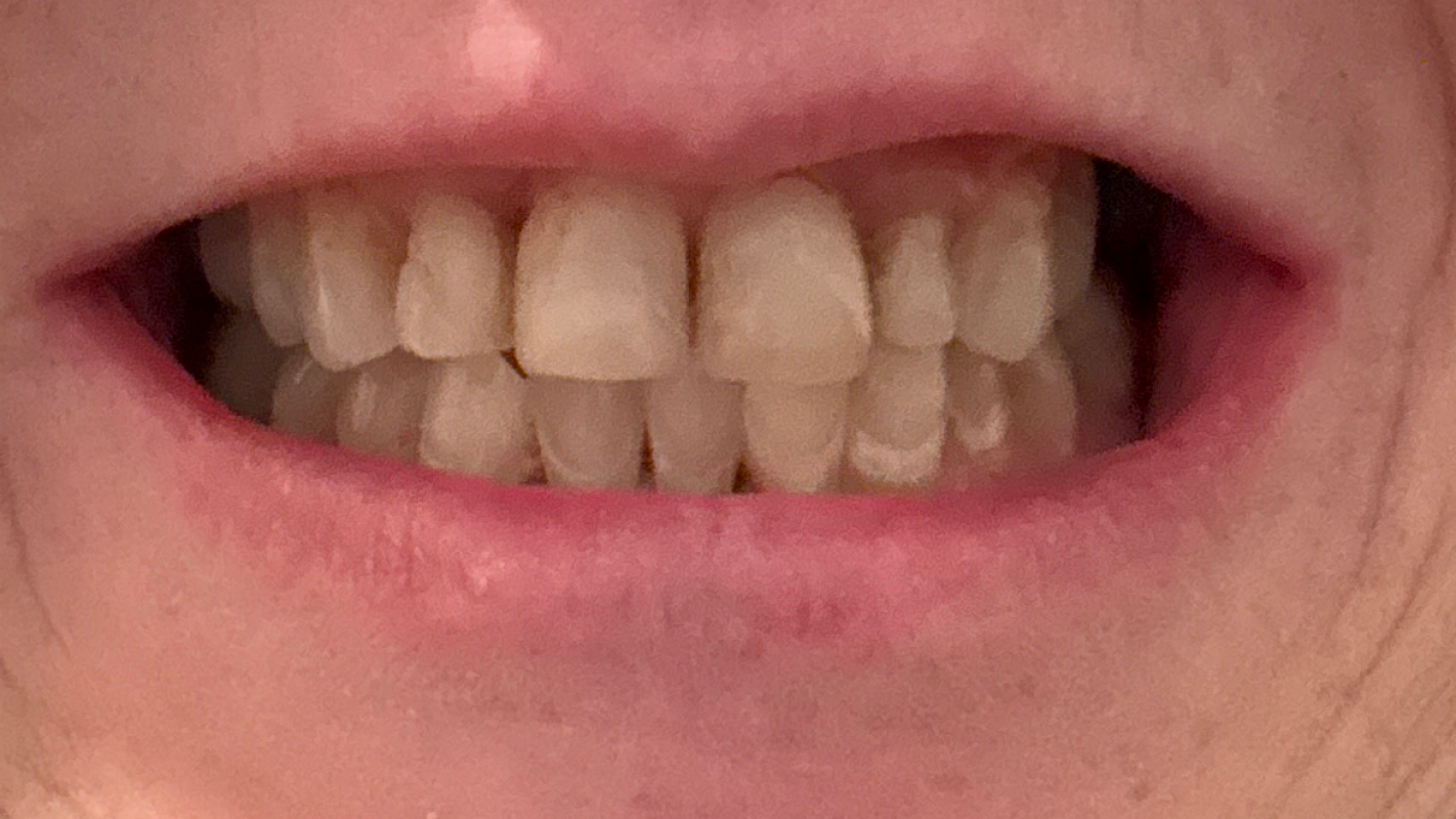 Help me smile again.