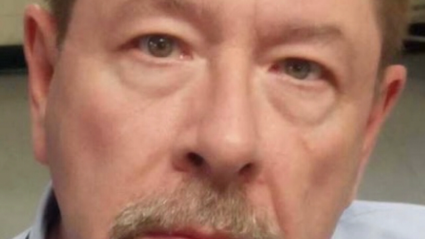 Hip replacement surgery and back surgery