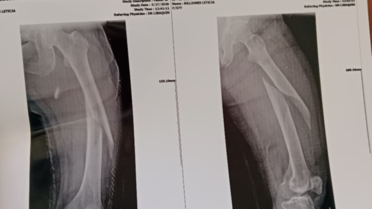 My soon to be mother in law