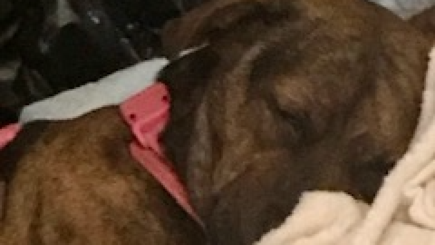 Emergency ileostomy surgery