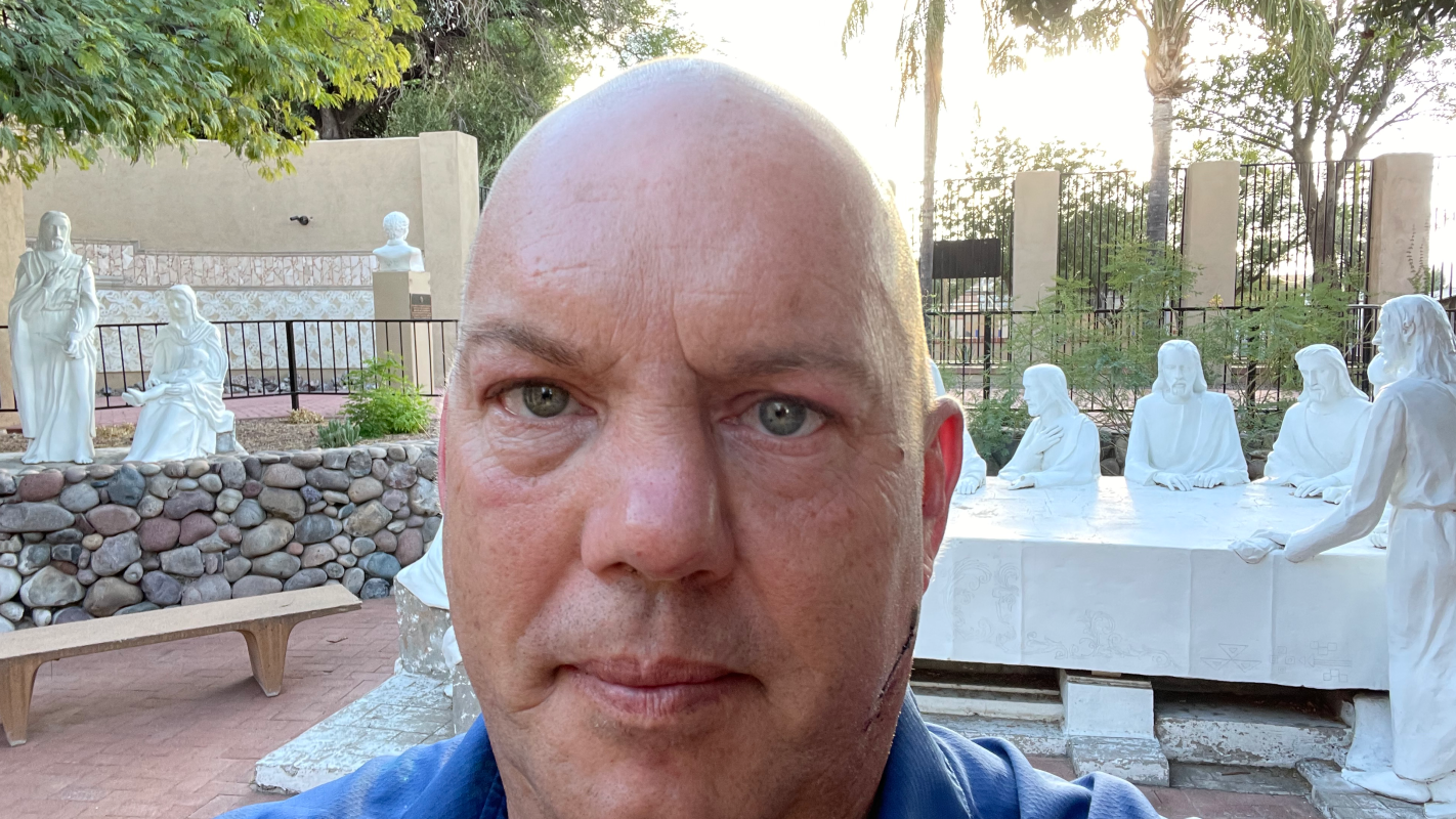 Stand up with Steven during his hip surgery and recovery!