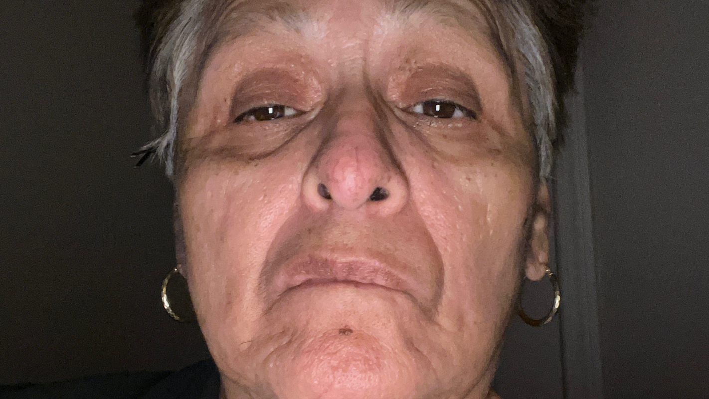 Diagnosed with cancer and having to do Chemo