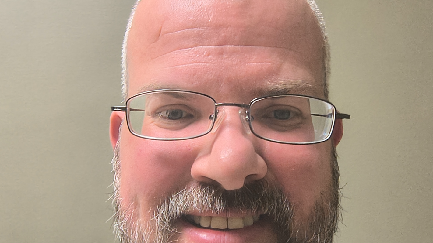 REI (Refractive Lens Exchange)