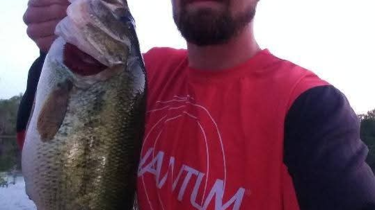 Heart valve and pacemaker replacement