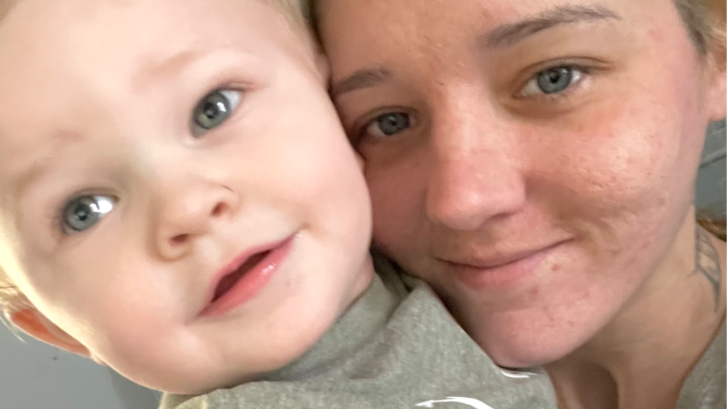 Full mouth Dental implants