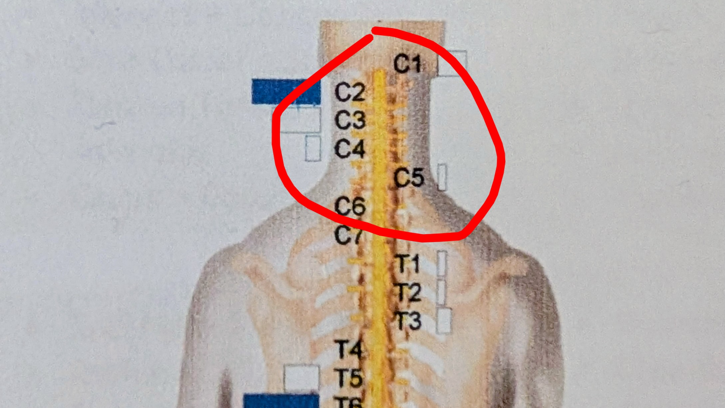 Help Me Escape This Prison and Fix My Neck.