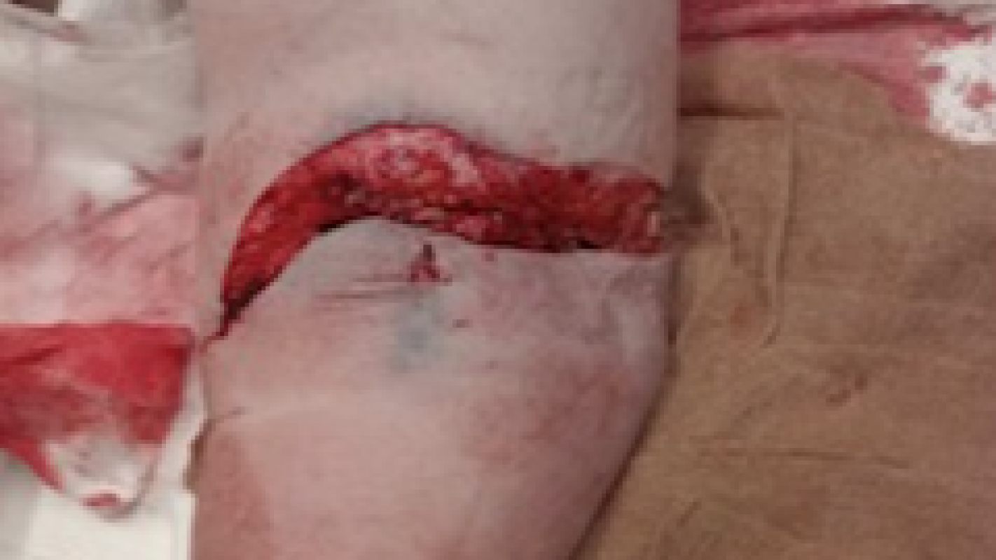 Emergency help for our daughter, Nicole (Anderson) Pruett