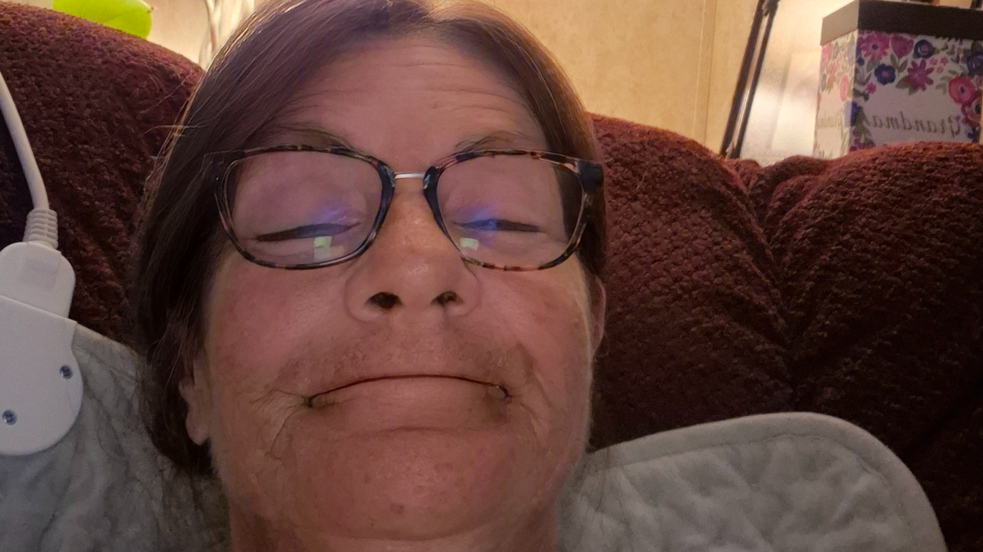 Help after 4th brain 🧠 surgery I still have aneurysms still in my brain 🧠