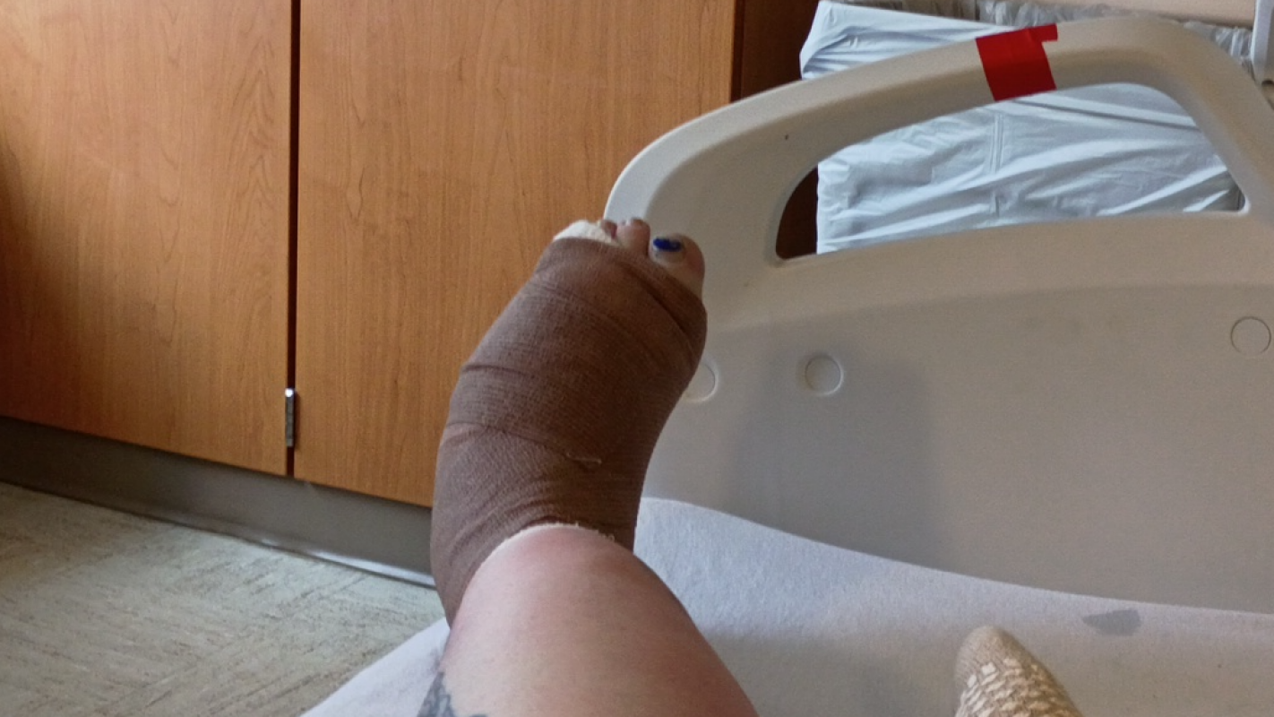 Out of work due to having to have a toe removed