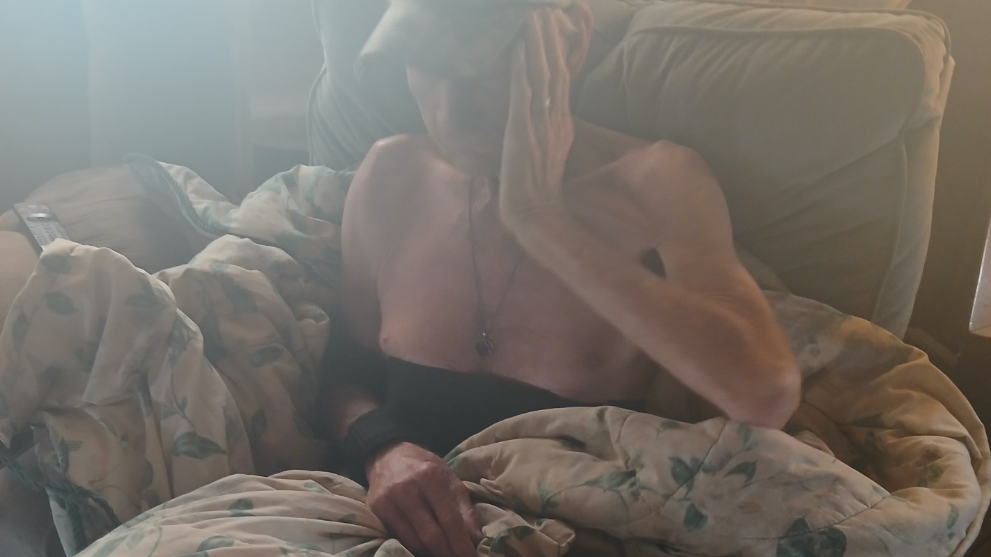Surgery deductible for shoulder replacement