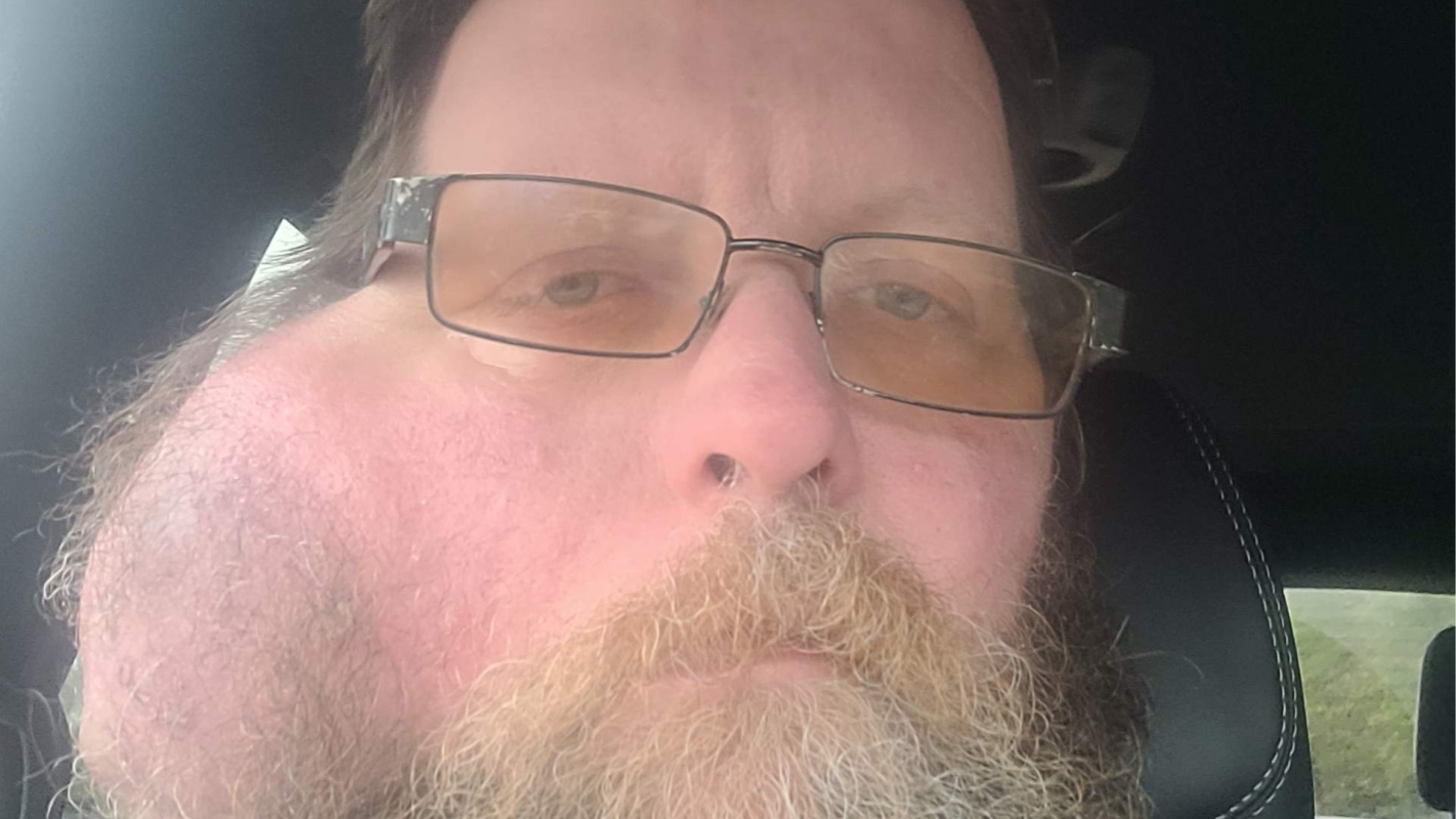 Help leo fight parotid cancer