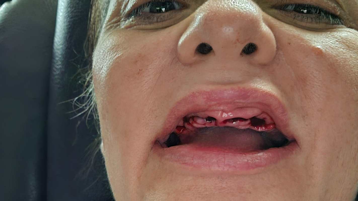 Help me smile again.