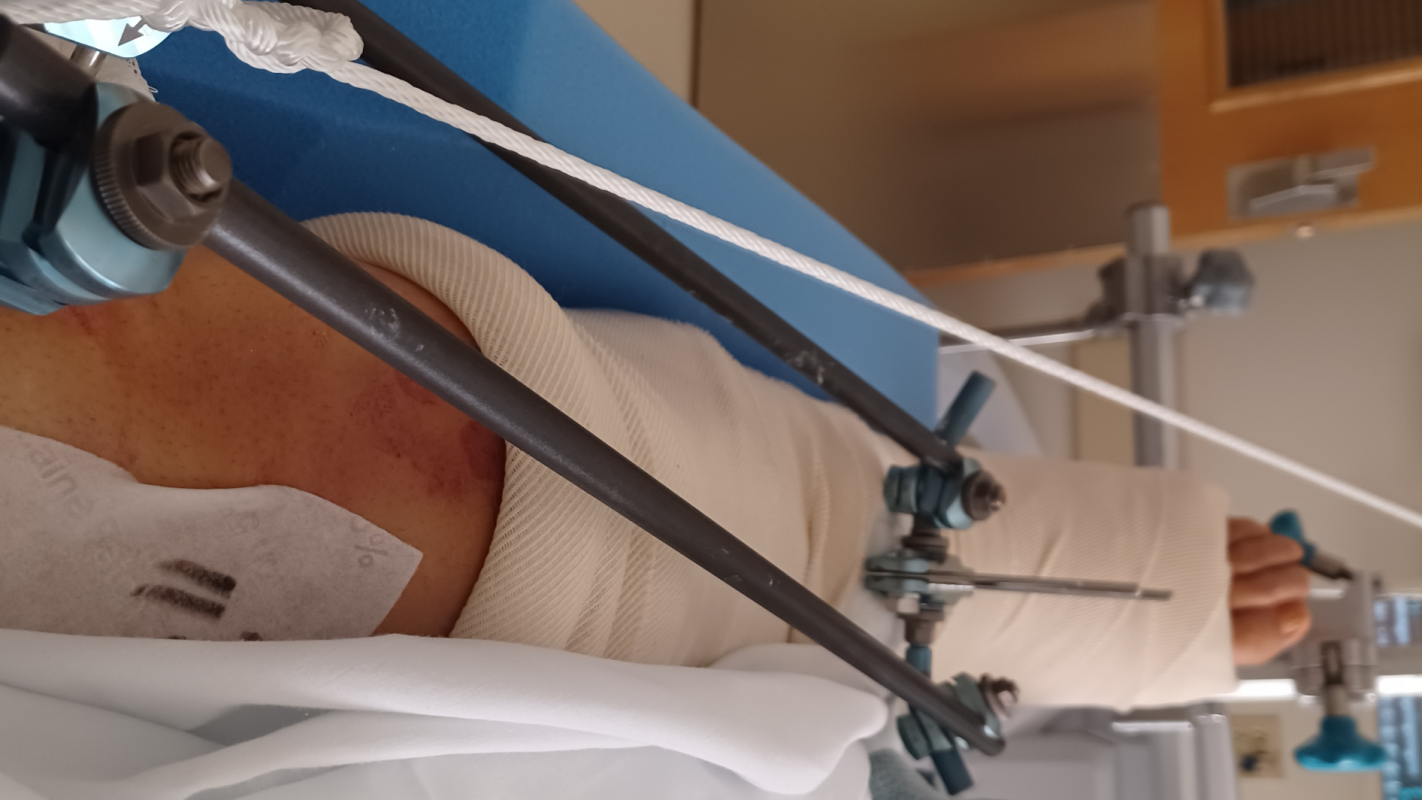Help get a car for doctor/specialist visits