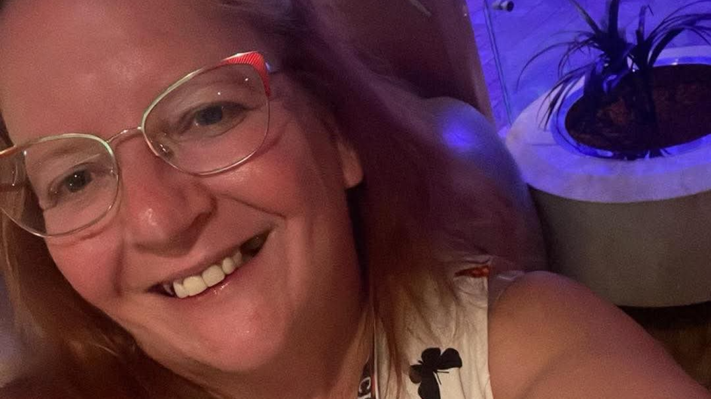 TONDA NEEDS A NEW HIP!!