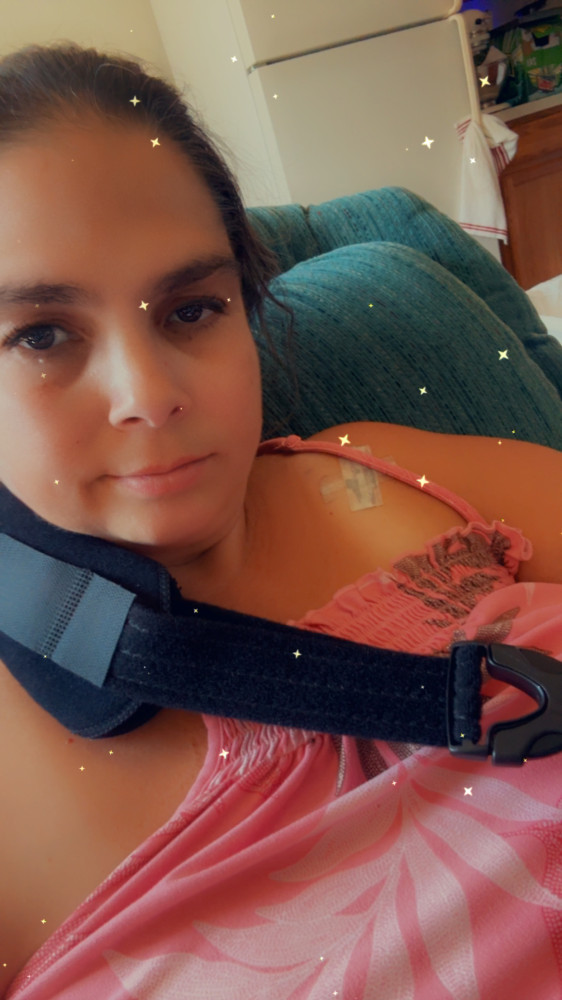 Almost a week post op