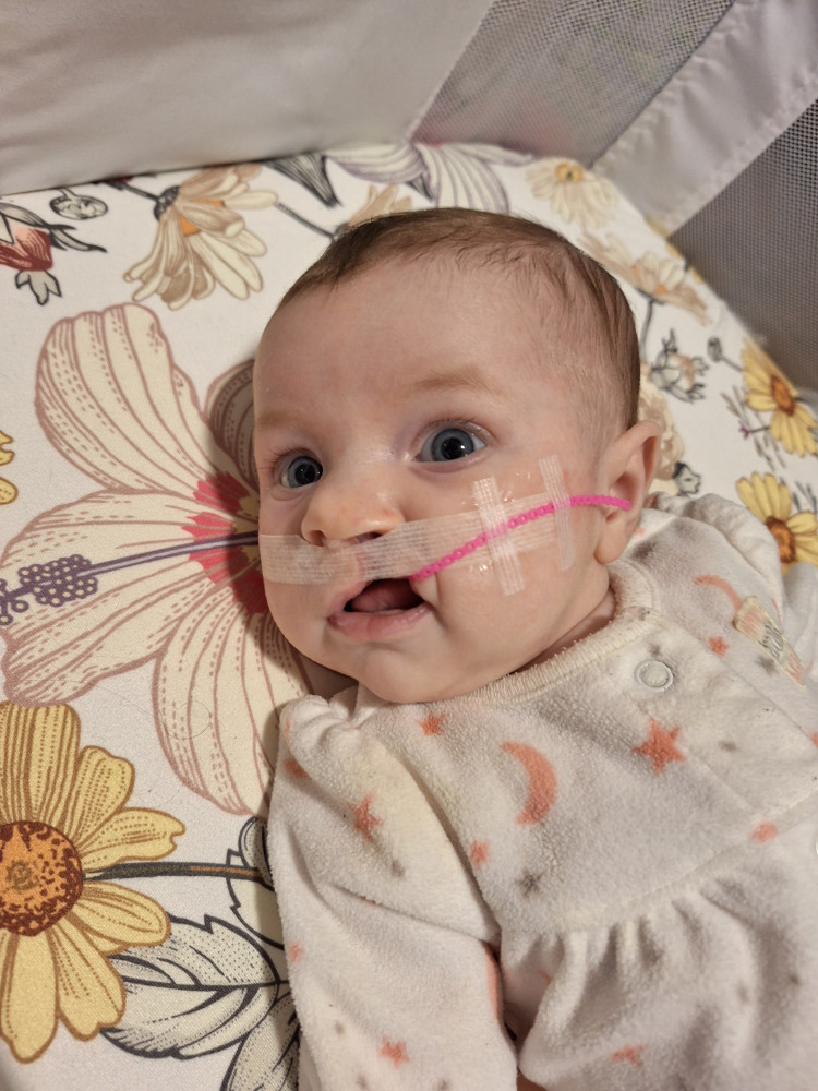 Cleft Care Journey for Ruth-Irene